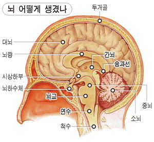 뇌경색·뇌출혈, 칼 안대는 치료법 확산