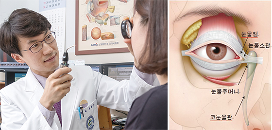 [Health] 찬 바람 불면 시도 때도 없이 흐르는 ‘눈물흘림증’ 원인은 안구건조증…인공눈물 자주 넣어야