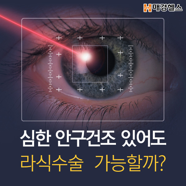 [건강스펀지] 심한 안구건조 있어도 라식수술 가능할까?