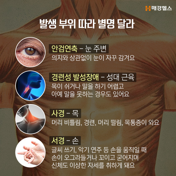 [그 병이 알고싶다] 
