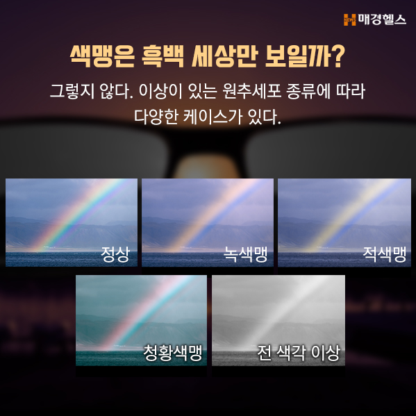 [그 병이 알고싶다] 색맹, 치료가 가능할까?