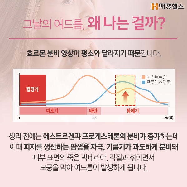 [여.의.사] 생리 때만 되면 왜 여드름이 날까?