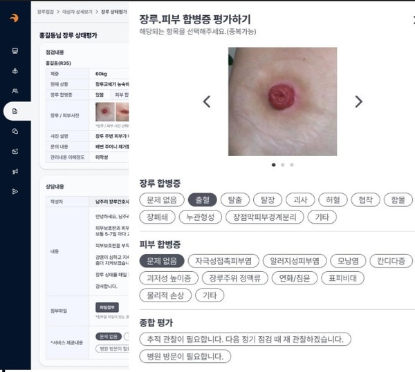 환자가 작성한 점검 내용을 의료진이 보고 장루상태를 평가 할 수 있다. 사진 = 헤링스