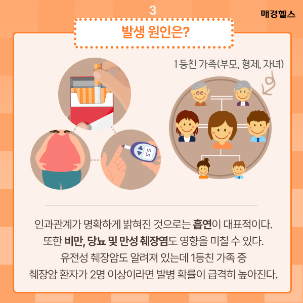 췌장암 증상이 궁금하다면? 7