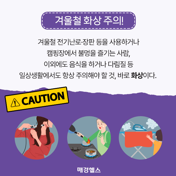 올바른 화상 응급처치 방법 [알쓸건잡]