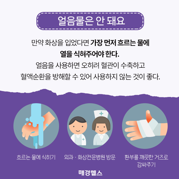 올바른 화상 응급처치 방법 [알쓸건잡]