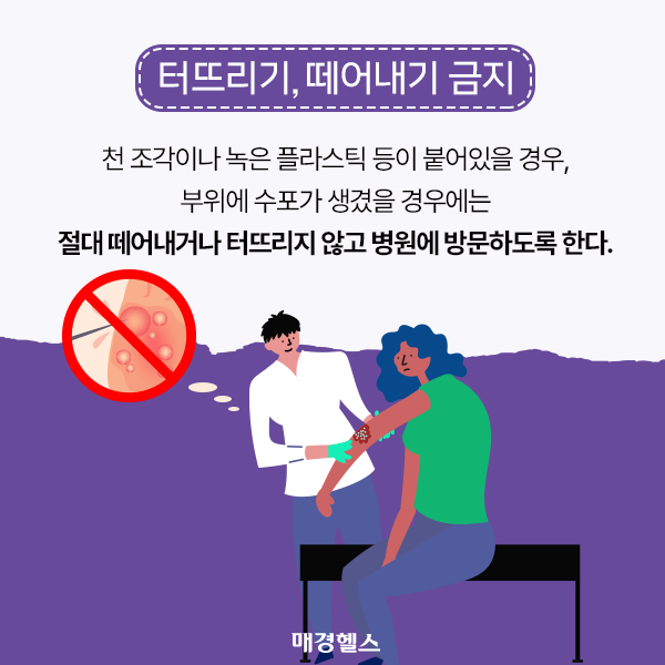 올바른 화상 응급처치 방법 [알쓸건잡]