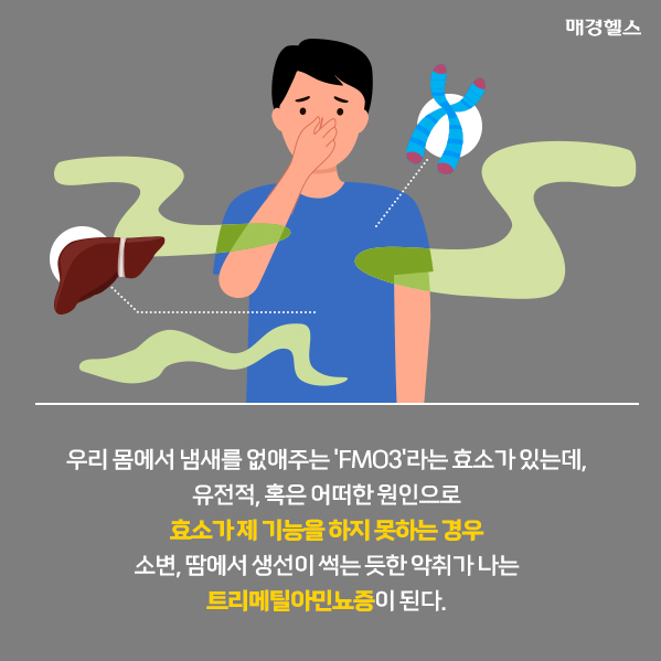 몸에서 생선 썩는 냄새가 나요…숨만 쉬어도 악취 풍기는 생선냄새증후군