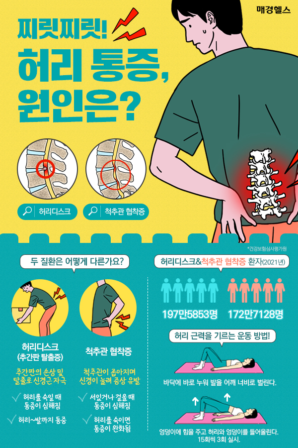 허리 통증 있어도 허리디스크 아닐 수 있어…허리 통증 원인은?