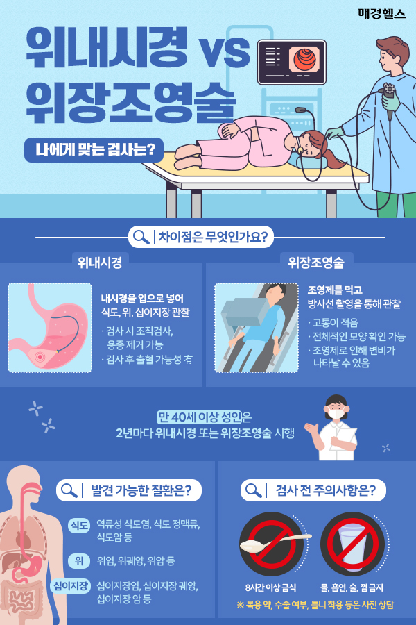 위내시경 vs 위장조영술…차이점은?