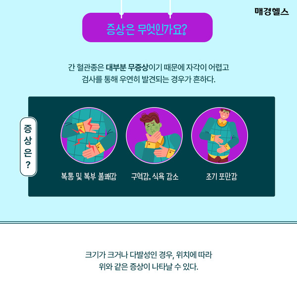 간에 생기는 가장 흔한 종양 '간 혈관종'은 무엇인가요?
