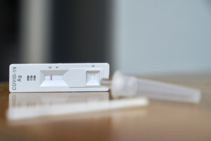 코로나 팬데믹 5년 대해부⑦ 코로나 확산이 호재였던 K-진단키트...국산... - 뉴스 썸네일 이미지