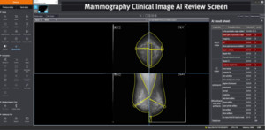 인비즈, AI융합 특수의료장비 영상품질검사 플랫폼 개발 - 뉴스 썸네일 이미지